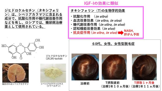 円形脱毛症　名医